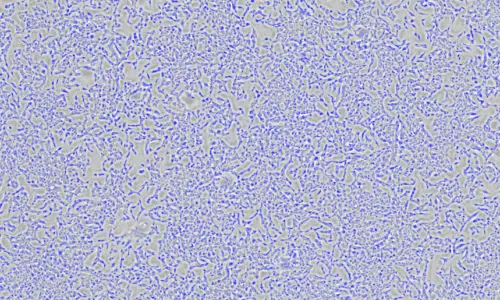 Cell Proliferation Assay