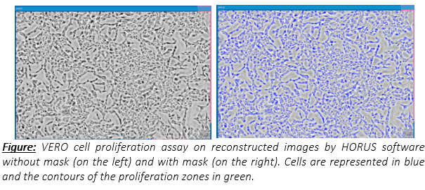 Cell confluence without mask