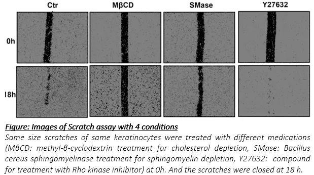 Resultats note application cell migration assay wound healing